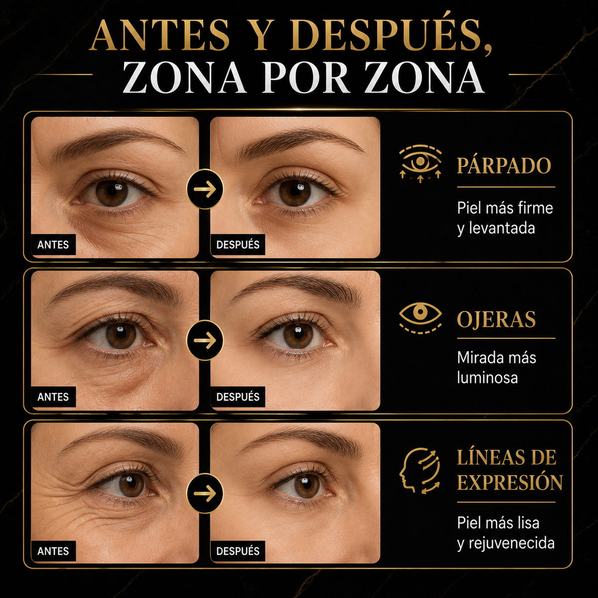 by Peter Thomas Roth® - Reduce Bolsas y Líneas en Minutos